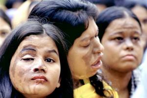Acid burned women in Pakistan
